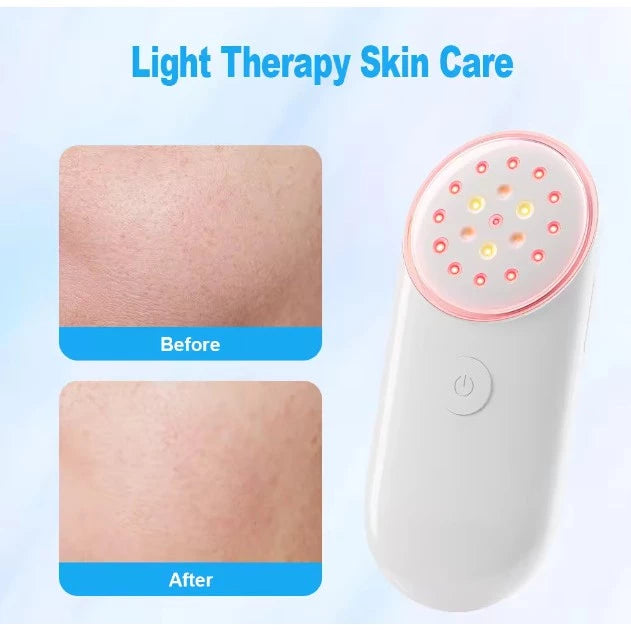 Portable Laser for Facial Beauty and Skin Rejuvenation/Alat kecantikan Anti-aging