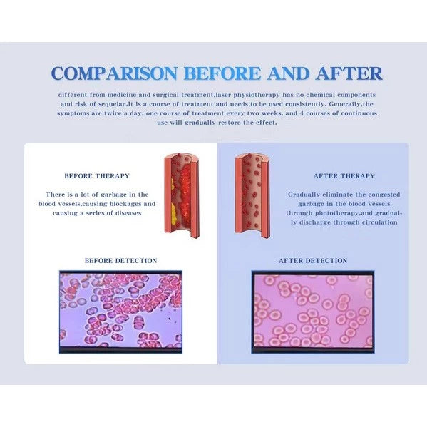 Jam Laser Terapi Darah & Jantung 10 Mata Laser Dr Phi Lee